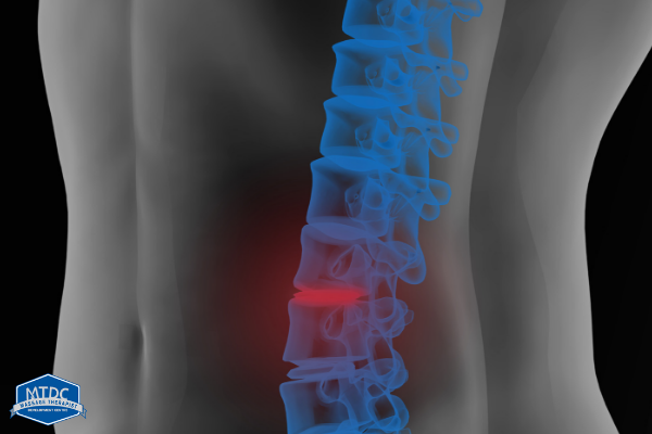 Degenerative Disc Disease Correlation To Pain Doesn’t Matter As Much As You Think