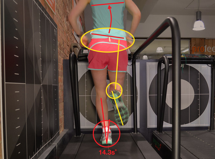 gait analysis research questions